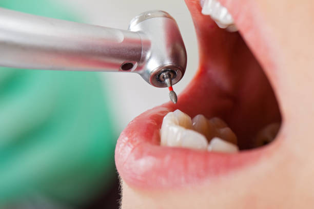Best Walk-In Emergency Dentist in Columbia, PA